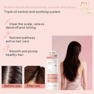 Champú Anticaspa, Antipicazón y Calmante con Extracto de Plantas y Aminoácidos, Venta al por Mayor OEM/ODM - Product Image 3