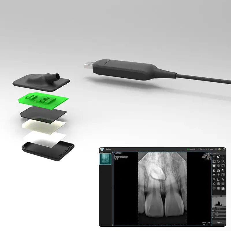 Dental Equipment Intra-Oral X Ray USB Digital Imaging System High Definition Intra Oral Sensor