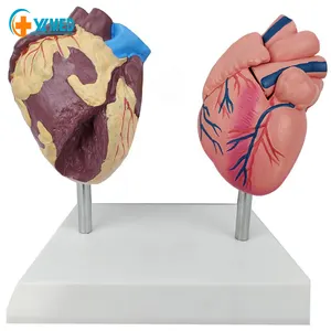 Анатомия человека, модель сердца, 2 части, ПВХ, Обучающие модели для здоровья сердца и больных, сравните модель сердца