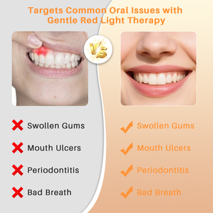 Dispositivo <span class=keywords><strong>dental</strong></span> da terapia clara vermelha do OEM para a ferramenta cura oral ortodôntica do alívio das dores com massagem da vibração - Product Image 6