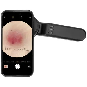 IBOOLO Mobile Handfernrohr-Derma toskop 90 Grad polarisiert zur Haut erkennung