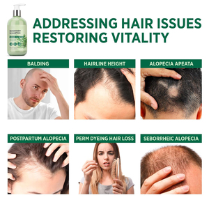 Champú en <span class=keywords><strong>Crema</strong></span> Orgánico para Engrosar el Cabello <span class=keywords><strong>con</strong></span> Romero y Aceite de Argán, Fórmula Nutritiva y Anticaspa para Hombres y Mujeres (2 en 1) - Product Image 4