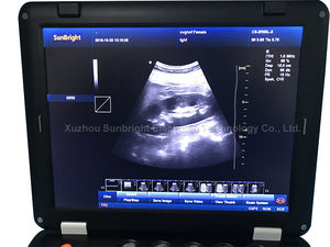 <span class=keywords><strong>Prix</strong></span> de l'appareil d'<span class=keywords><strong>écho</strong></span>graphie numérique complet, <span class=keywords><strong>écho</strong></span>graphie cardiaque, obstétrique, <span class=keywords><strong>Doppler</strong></span> couleur - Product Image 3