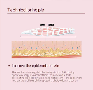 Equipo de Belleza para el Hogar, Masajeador Facial Antienvejecimiento Pequeño, Longitud de Aguja de 1.5 mm, Dispositivo Metálico de 5 mm para Lifting Facial y Rejuvenecimiento de la Piel - Product Image 4