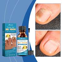 Ximonth vente en gros de haute qualité champignons venin d'abeille Solution de traitement des champignons des ongles antibactérien réparation des ongles Essence de soin des ongles