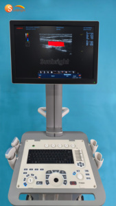 Ecógrafo de Carro SUN-907B de Alta Resolución con Doppler Color 3D 4D PW CW para Uso Hospitalario - Product Image 4