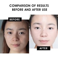 Sérum à la Vitamine C Anti-Âge Vente en Gros Marque Blanche Hydratant Éclaircissant Visage et Correcteur de Taches Noires