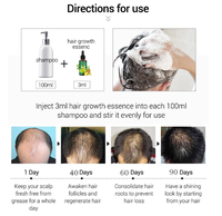 Losion Serum pelurus rambut, minyak Losion Serum penumbuh rambut, menipiskan rambut dan rambut rontok