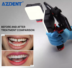 Đèn pin intraoral nha khoa cập nhật dễ dàng hơn để cài đặt với ống kính macro và đèn <span class=keywords><strong>Flash</strong></span> chụp ảnh rút lại để chụp ảnh - Product Image 3