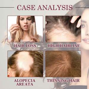 น้ำมันบำ<span class=keywords><strong>รุ</strong></span><span class=keywords><strong>ง</strong></span>ผ<span class=keywords><strong>ม</strong></span>โอฮอย สำหรับผู้ชายและผู้หญิง ป้องกันผ<span class=keywords><strong>ม</strong></span>ร่วง ไบโอติน น้ำมัน<span class=keywords><strong>ม</strong></span>ะพร้าว แม่เอิร์ธ ไทยแลนด์ น้ำมันหัวหอมแด<span class=keywords><strong>ง</strong></span> สำหรับ<span class=keywords><strong>ผม</strong></span>ยาว บำ<span class=keywords><strong>รุ</strong></span><span class=keywords><strong>ง</strong></span>เส้นผ<span class=keywords><strong>ม</strong></span> ลดการหลุดร่ว<span class=keywords><strong>ง</strong></span> สำหรับผู้มีปัญหา<span class=keywords><strong>ผม</strong></span>ร่วง - Product Image 3