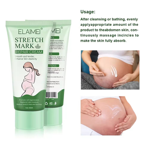 Crème Réparatrice Anti-Cicatrices 60ml – Atténue les Lignes Fines, Lisse et Raffermit, Anti-<span class=keywords><strong>Vergetures</strong></span> <span class=keywords><strong>pour</strong></span> Mères – Soin de la Peau en Gros - Product Image 4
