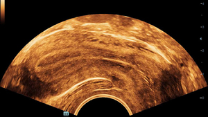Appareil d'échographie Mindray DC-70 X-sight pour usage vétérinaire avec système d'imagerie diagnostique et échographie Doppler couleur Full HD - Product Image 5