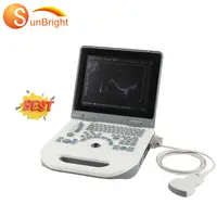 Scanner Médical Obstétrique 3D Portable, Machine à Échographie pour la Grossesse, Battement de Cœur, Dispositif USB
