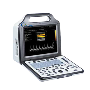 Nhà Máy Giá xách tay máy siêu âm Độ phân giải cao b-scan siêu âm máy cho bụng thú y thiết bị bw21a - Product Image 3