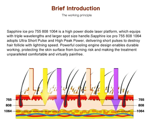 Máquina de Depilación Láser de Diodo de Uso Comercial de 755/808/1064 nm con Enfriamiento por Aire/Agua/Semiconductores, 110 V/220 V, Garantía de 2 Años - Product Image 5
