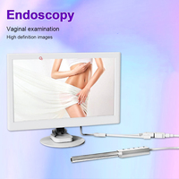 Tragbares Kabelloses Endoskop-Kamerasystem für Zuhause HD-Endoskopkamera Vaginale Endoskopie-Untersuchung