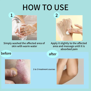 Ungüento Herbal Exclusivo OEM, Soluciona Diversos Problemas de la Piel, Suave y de Fácil Absorción, Crema Calmante Herbal Exclusiva - Product Image 5