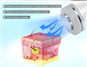 Dispositivo Láser Portátil de 980nm para Terapia Vascular, <span class=keywords><strong>Hongos</strong></span> <span class=keywords><strong>en</strong></span> <span class=keywords><strong>las</strong></span> Uñas y Eliminación de Arañas Vasculares - Product Image 3