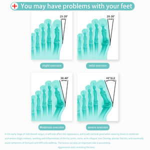 Venta caliente Separadores <span class=keywords><strong>de</strong></span> <span class=keywords><strong>dedos</strong></span> Pedicura Medicus Protectores <span class=keywords><strong>Separador</strong></span> <span class=keywords><strong>de</strong></span> <span class=keywords><strong>dedos</strong></span> <span class=keywords><strong>de</strong></span> juanete <span class=keywords><strong>de</strong></span> silicona - Product Image 5