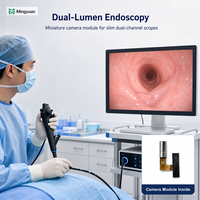 Module de caméra CMOS, longueur 15 mm, champ de vision 100 degrés, pour Windows, Android et intégration de systèmes médicaux personnalisés