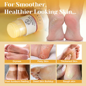 Stick de soin des pieds à l'huile de cheval, emballage personnalisé, réparation des talons fissurés, crème hydratante pour les mains et les pieds - Product Image 3