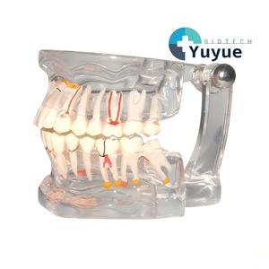 Modelo Dental Transparente <span class=keywords><strong>de</strong></span> Tamaño Real con Dientes Patológicos para Demostración en la Enseñanza Dental - Product Image 1