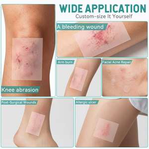 Bande hydrocolloïde mise à jour pour le soin des plaies, pansements hydrocolloïdes de qualité médicale avec adhésif auto-adhésif, flexibles et imperméables - Product Image 6