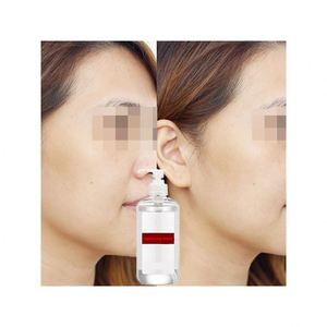 L'acido ialuronico magico giovane sbiancare mantenere la pelle giovane illuminante Tonelighten siero cosmetici OEM/ODM fornitura di fabbrica - Product Image 1