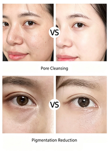 Appareil professionnel d'hydrodermabrasion, nettoyage en profondeur des pores, élimination des points noirs, hydratation de la peau du visage, machine à oxygène - Product Image 5