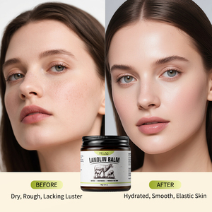 <span class=keywords><strong>Crema</strong></span> Idratante Naturale a Marchio Privato Previene Secchezza e Screpolature Balsamo Lenitivo <span class=keywords><strong>per</strong></span> il <span class=keywords><strong>Viso</strong></span> con Lanolina - Product Image 3