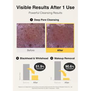 Missha Vita C All In One Foam Cleanser 200ml con Vitamina C para una Limpieza Profunda - Product Image 3