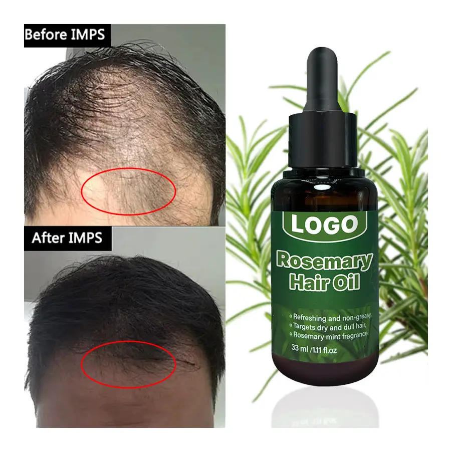 Vitamines de marque privée pour le soin des cheveux abîmés Traitement personnalisé pour cheveux bouclés à l'huile de romarin aux herbes et bio