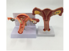Modèles anatomiques grandeur nature de l'organisme vaginal et ovarien féminin et modèles anatomiques pathologiques de l'utérus pour l'enseignement médical CE/ISO