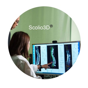 Scoliosis Assessment System 3D Analysis Software With AI Algorithm For Physiotherapy - Product Image 2