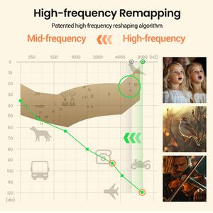 Shenzhen Flysounds <span class=keywords><strong>Medical</strong></span> Technology RIC BTE Prothèse auditive Fréquence étendue 8000Hz Clip Protector et anti-perte Caractéristiques - Product Image 6