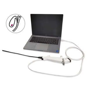 Endoskop Fleksibel Sekali Pakai untuk Kolangkok dengan Pencitraan Definisi Tinggi untuk Pengangkatan Batu Empedu - Product Image 3