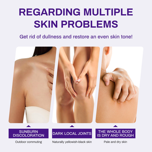 Blanqueamiento más efectivo Lotiom Ingle Blanqueamiento del área íntima, cremas blanqueadoras nupciales, <span class=keywords><strong>crema</strong></span> blanqueadora facial - Product Image 4