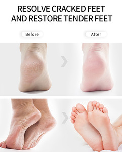 Fabricación Hidratante Blanqueador Hidratante y Antiarrugas Lavanda Aloe Vera Foot Peel Mask Calcetines Suministro sanitario - Product Image 3