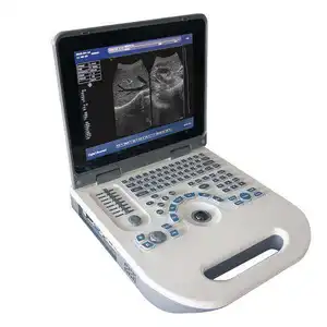 Machine de diagnostic par ultrasons BW entièrement numérique du fabricant pour l'examen