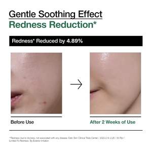 Anua Heartleaf 80 Moisture Ampoule 30Ml Suero Calmante Para el Rostro - Product Image 6