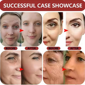 Serum perawatan kulit Anti penuaan, Serum perawatan kulit Anti penuaan, Serum kecantikan Anti Penuaan, Label pribadi, cair, asam Hyaluronic, untuk wanita - Product Image 2