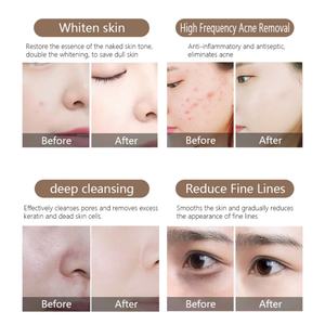 Máquina Facial de Hidro-Oxigenoterapia de Alta Calidad 9 en 1, Hidratante, Portátil, con Pantalla Táctil, para Uso en Salones de Belleza - Product Image 5