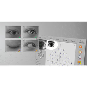 جهاز تحليل المجال البصري بسعر المصنع جهاز تحليل العيون المحيط التلقائي لاختبار العين - Product Image 4