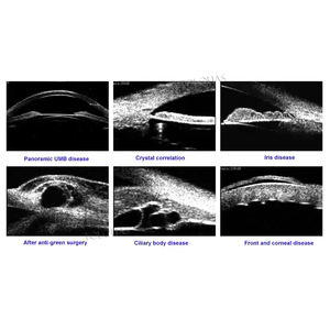 BM hewan medis <span class=keywords><strong>UBM</strong></span> <span class=keywords><strong>Ultrasound</strong></span> Biometer skala penuh portabel warna mesin <span class=keywords><strong>Ultrasound</strong></span> Doppler - Product Image 3