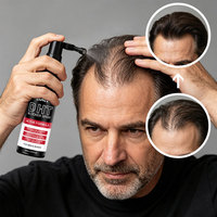 Shampooing pour la croissance des cheveux, vegan, anti-DHT, réduisant la casse, améliorant la santé des cheveux, shampooing à la biotine et à la kératine pour hommes, fourni par l'usine