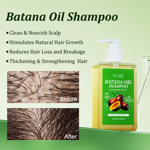 Private Label Batana Oil Rosemary Extract <b>Shampoo</b> 300ml Natural Botanical Hair Nourish for Thinning Damaged Hair All Types - Product Image 1