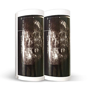 Kertas Thermal Gulung Tipe V Ulstar UPP-110HG untuk Printer Sony Medicare - Product Image 5