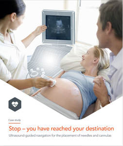 ADVANTECH MIC-3395 MIC-3395A1-M4E MIC-3395A REV.A102-1 6U CompactPCI Procesador Intel Core i3/i5/i7 de 2.ª y 3.ª Generación - Product Image 6