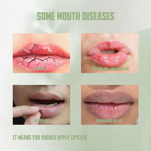 HOYGIダークリムービングリップバーム保湿腫れピーリングクラッキングブラックニングリップ修理リップクリームリムーバーズ - Product Image 3