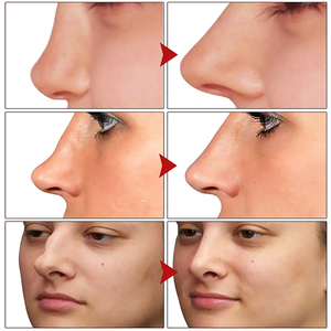 Huile Essentielle West Month pour le Nez : Nourrissante, Hydratante, Améliore la Circulation Nasale et Rehausse le Nez - Product Image 3